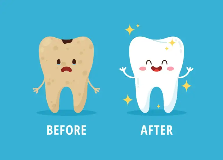Bright Smiles After Braces: Whitening with Confidence at Rising Stars