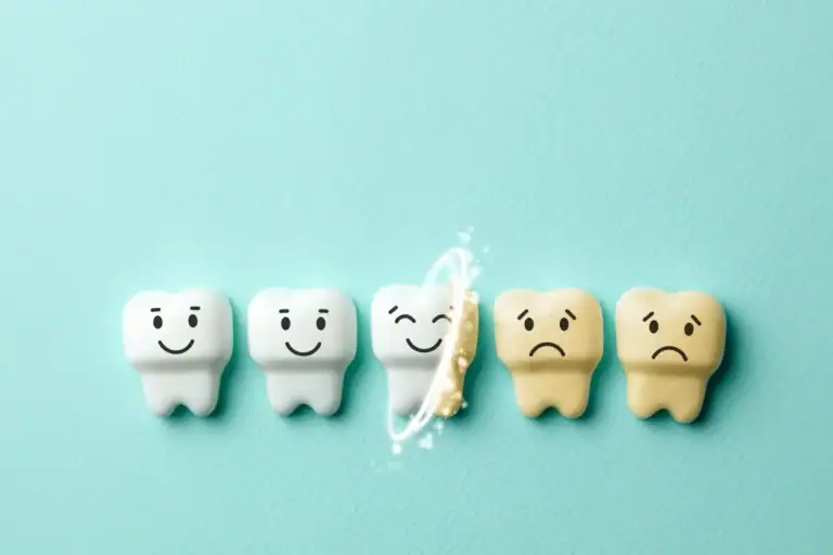 How to Whiten Teeth: Different Options