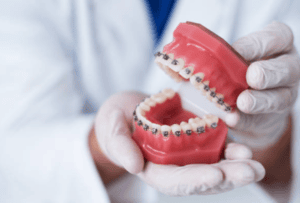 Best orthodontist in Austin TX