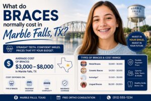 What do braces normally cost in Marble Falls, TX?