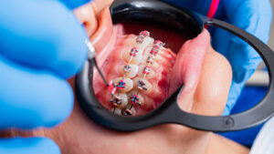 Why Families Trust Rising Stars Dental for Pediatric & Orthodontic Care in Austin, TX 